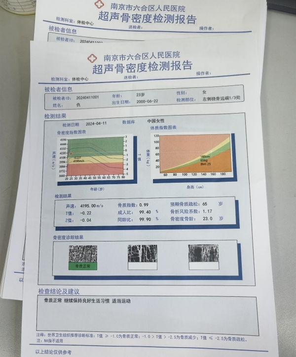 一文了解超聲骨密度儀的基本原理、技術(shù)特點及應(yīng)用領(lǐng)域